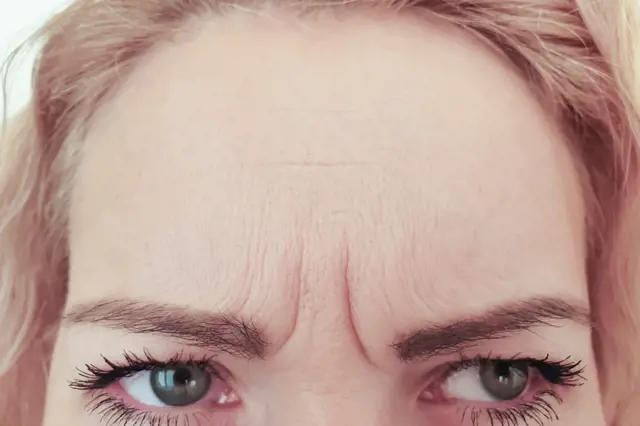 Vráska mezi očima na čele ženy