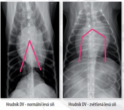 Srovnání hrudních RTG psa: normální vs. zvětšená levá síň